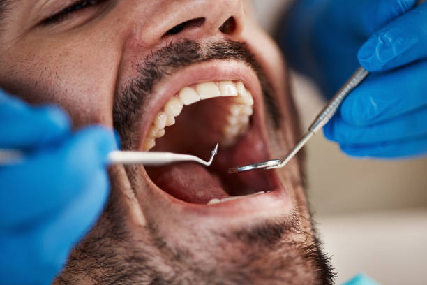 Best Cracked Tooth Emergency Dentist  in Briar Chapel, NC