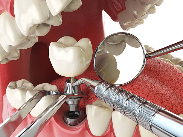 Best Urgent Tooth Repair  in Briar Chapel, NC